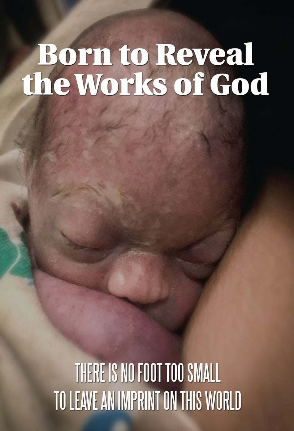 Born to Reveal the Works of God - [DVD]