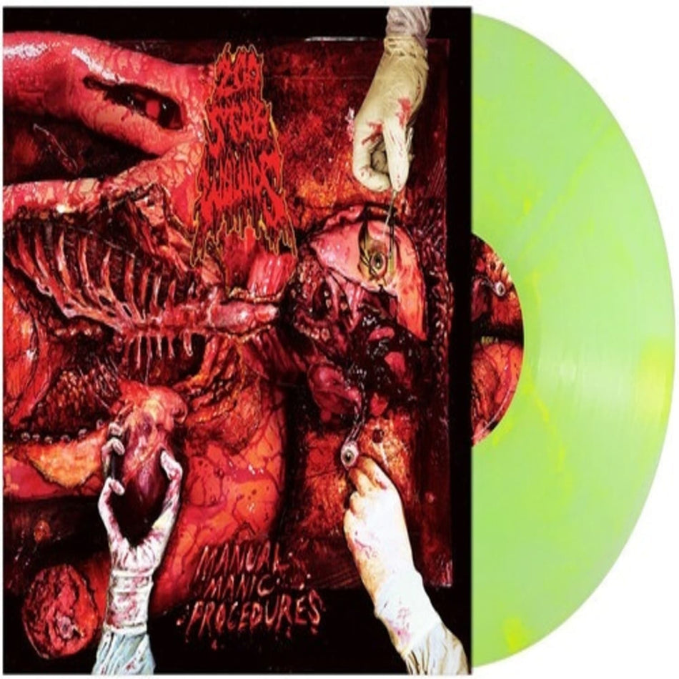 200 Stab Wounds - Manual Manic Procedures - (Colored , Green, Yellow, Marble) - [Vinyl]