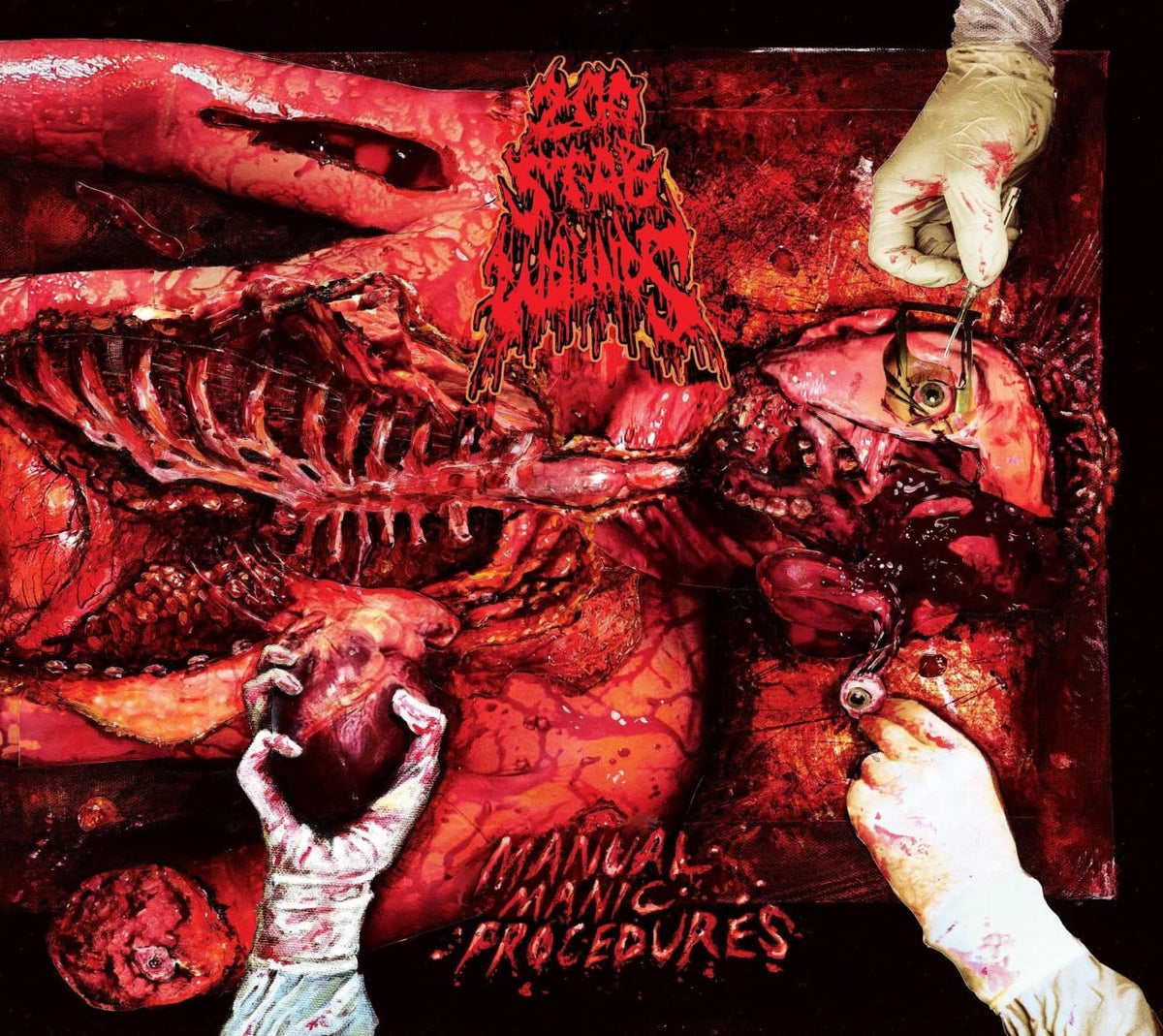 200 Stab Wounds - Manual Manic Procedures - [CD]