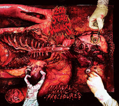 200 Stab Wounds - Manual Manic Procedures - [CD]