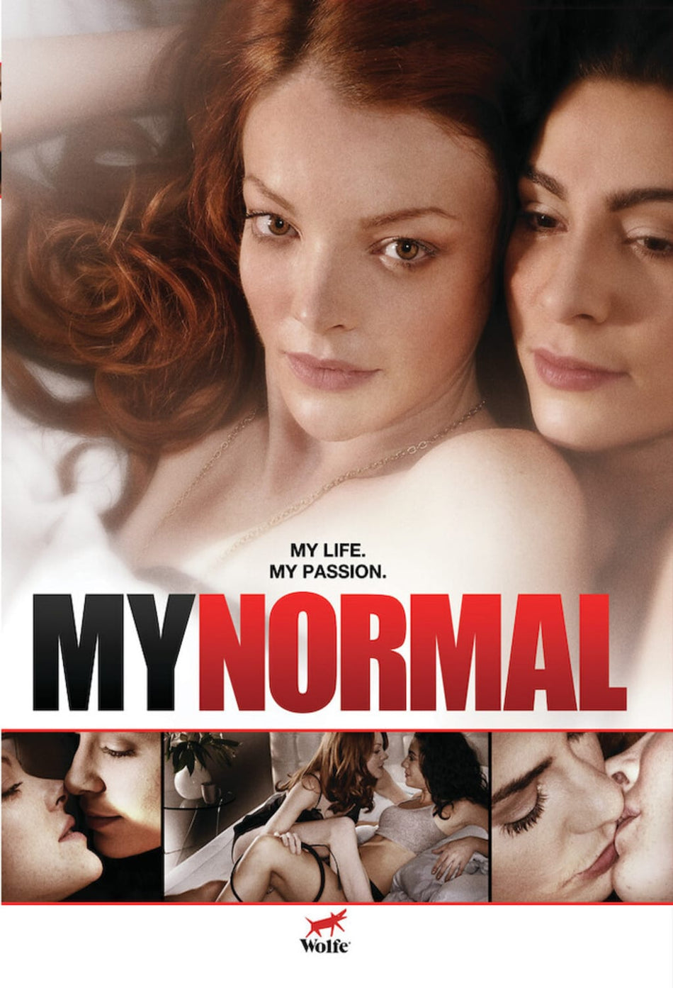 My Normal - [DVD]