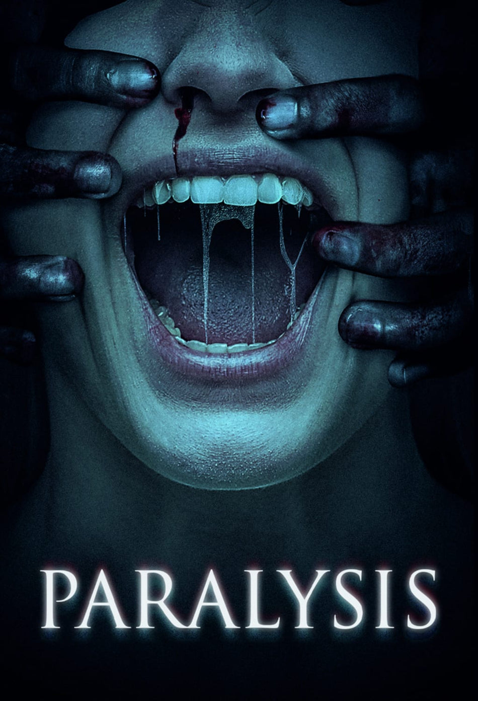 Paralysis - [DVD]