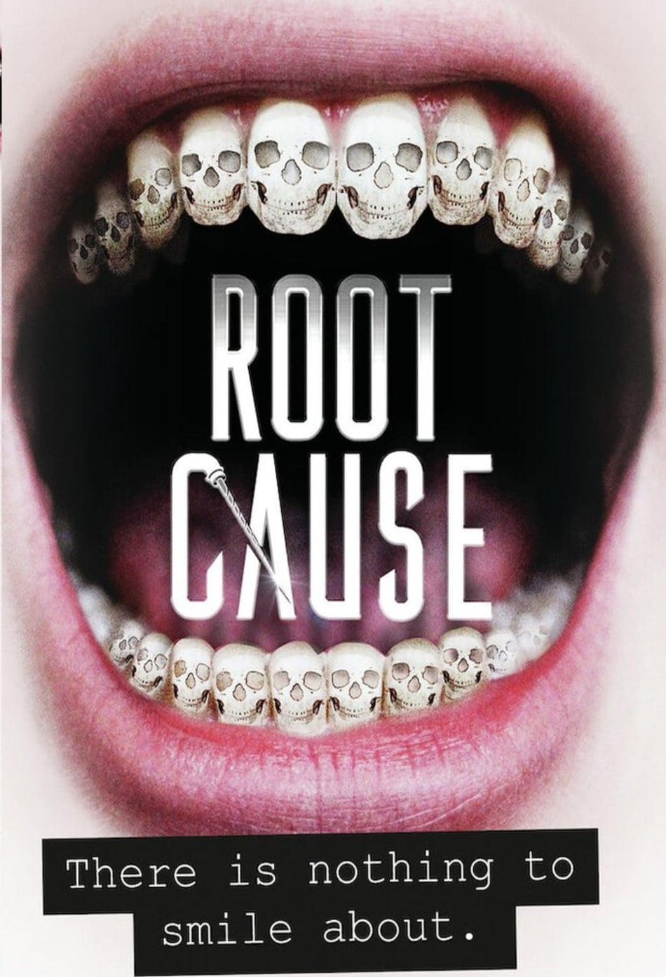 Root Cause - (Subtitled) - [DVD]