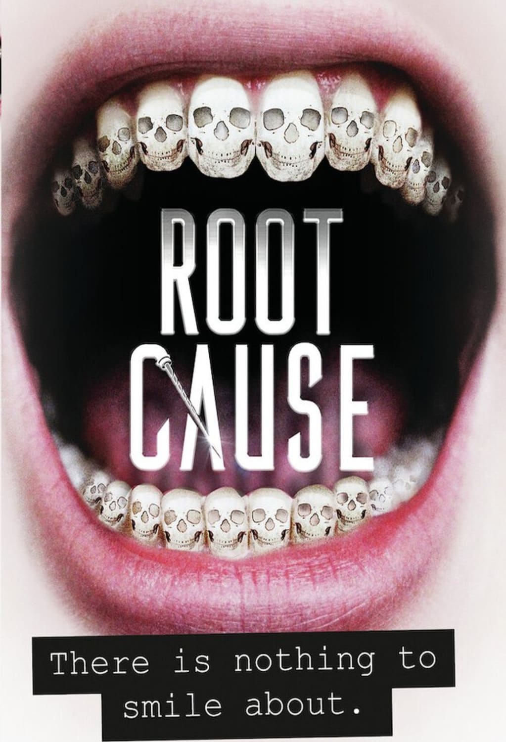Root Cause - (Subtitled) - [Blu-ray]