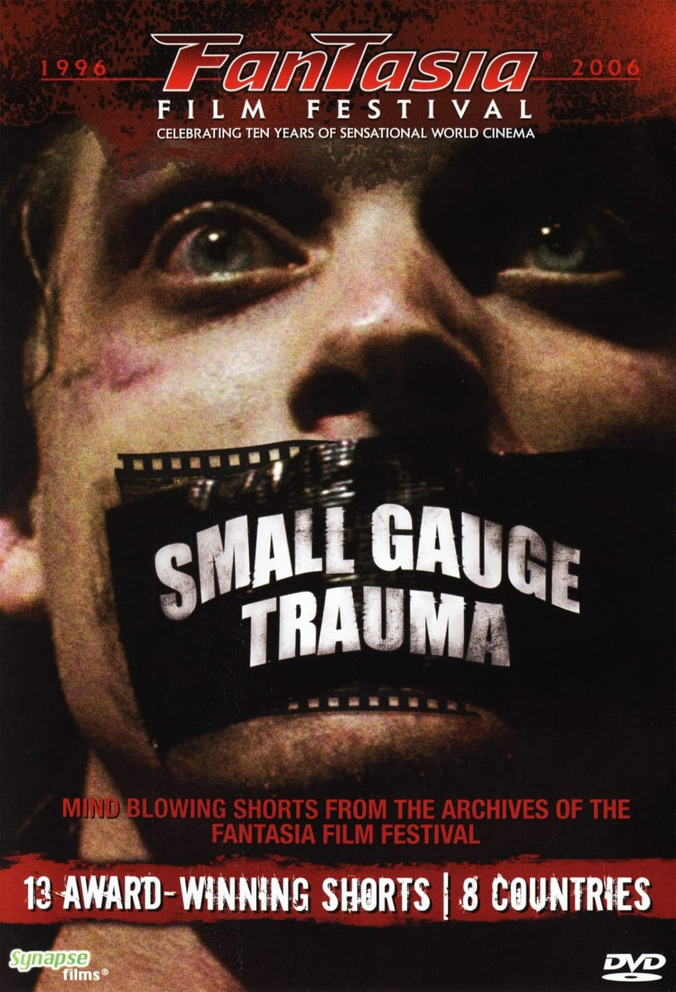 SMALL GAUGE TRAUMA - [DVD]
