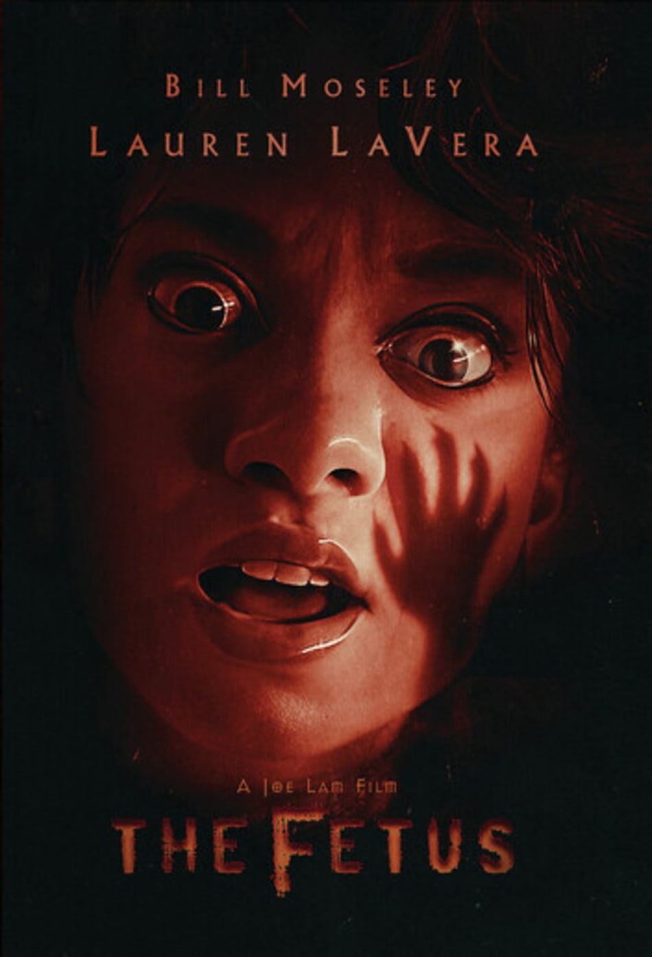 The Fetus - [DVD]