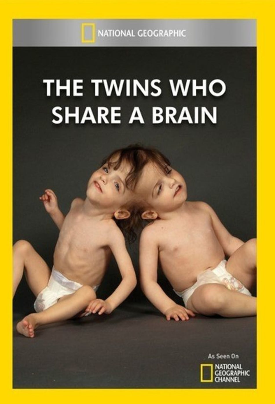 Twins Who Share a Brain - (NTSC Format) - [DVD]